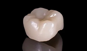 Dental Crowns — cosmetic dentistry service at Cosmetic Dentistry Center NYC