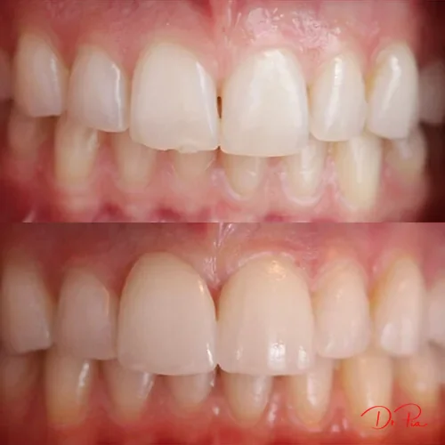 Why Does My Tooth Hurt? Common Causes and How to Get Relief