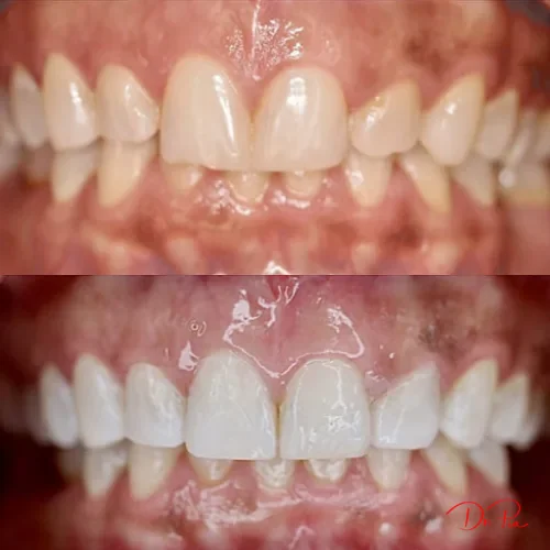 Teledentistry: Can You Really See a Dentist Online?