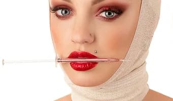 HA Fillers — cosmetic dentistry service at Cosmetic Dentistry Center NYC