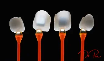 Composite vs. Porcelain Veneers: Which Should You Choose?