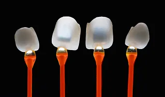 Porcelain Veneers — cosmetic dentistry service at Cosmetic Dentistry Center NYC