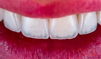 How Much Does Cosmetic Dentistry Cost? A Realistic Breakdown