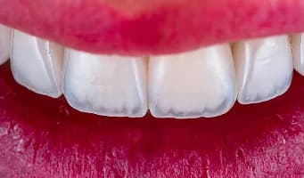 Cosmetic Dentistry — cosmetic dentistry service at Cosmetic Dentistry Center NYC