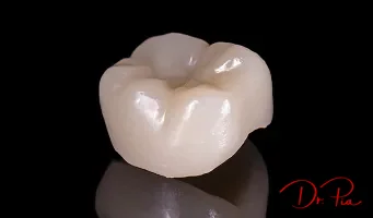 Dental Crowns: When You Need One and What to Expect
