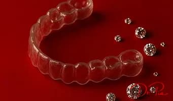 Crooked Teeth: Should You Straighten Them or Cover Them?