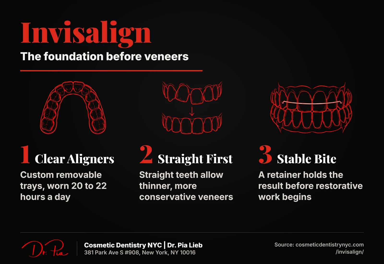 Invisalign, the foundation before veneers: clear aligners, straight first, stable bite