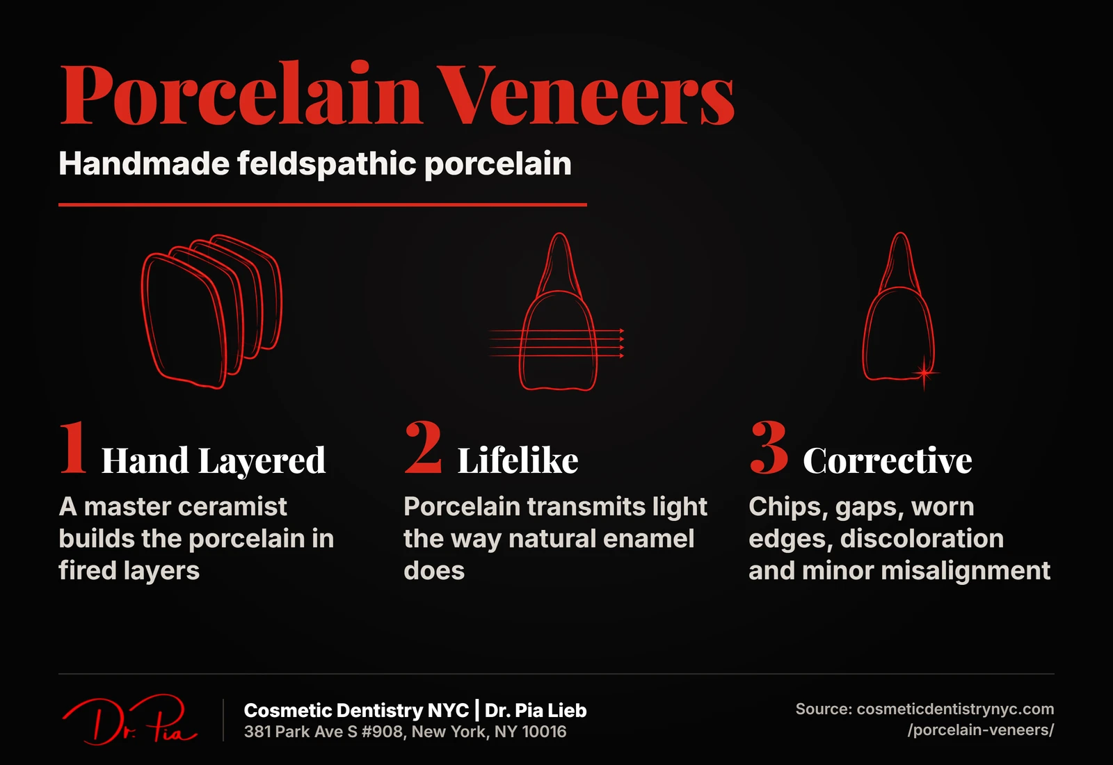 Porcelain veneers: custom shade, thin ceramic shell, front tooth restoration